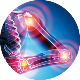 근골격계질환 일러스트