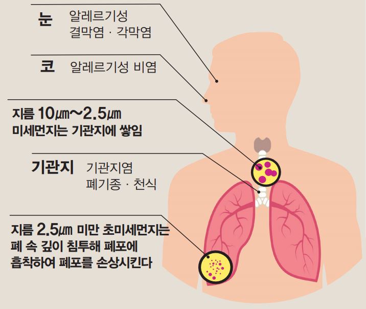 미세먼지가 유발하는 각종 질병?